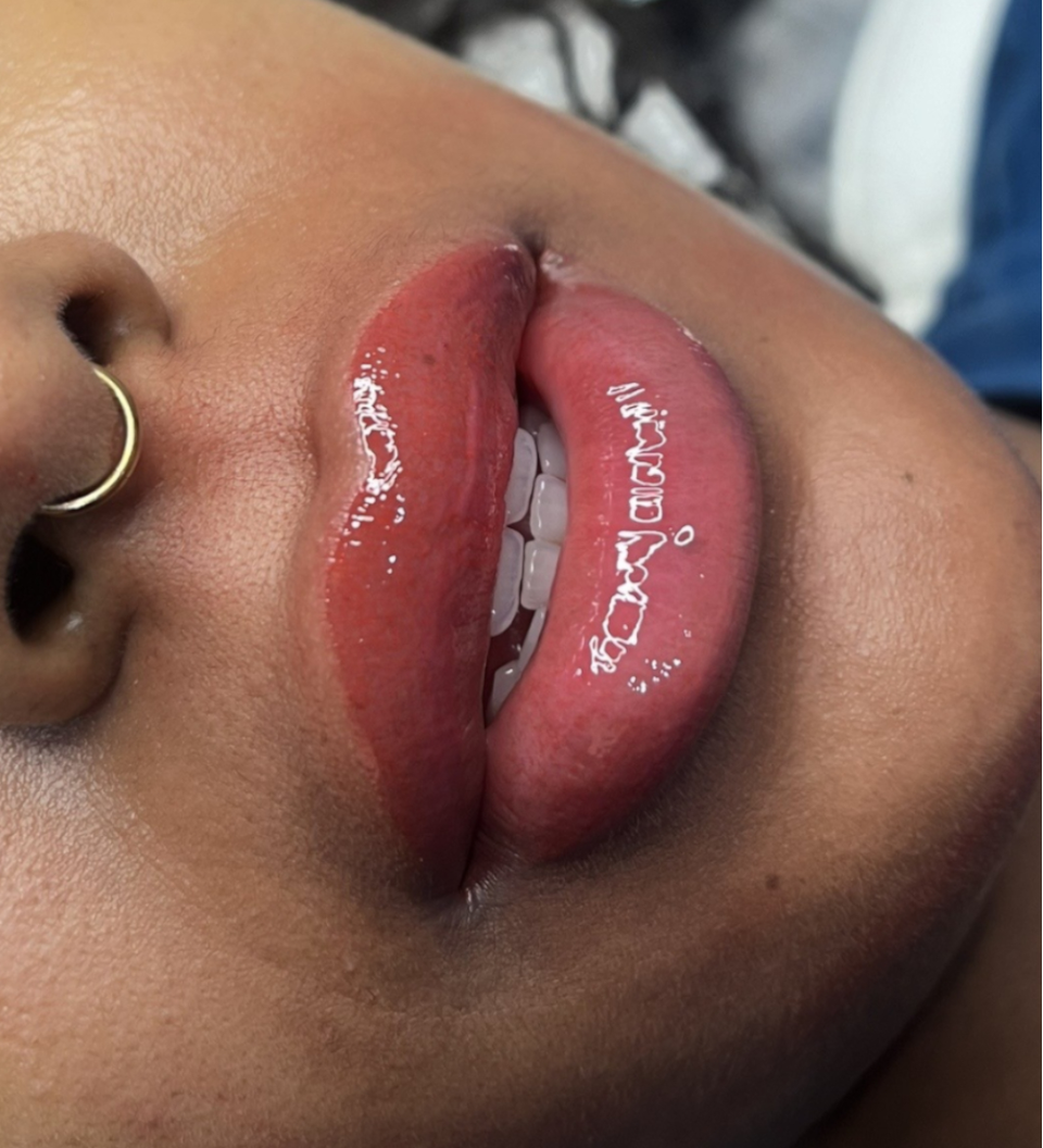 lip nuetralization
